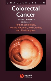 Enlarge image Cover: Challenges in Colorectal Cancer - Wiley