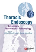 Cover: Thoracic Endoscopy - Wiley
