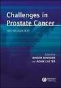 Cover: Challenges in Prostate Cancer - Wiley