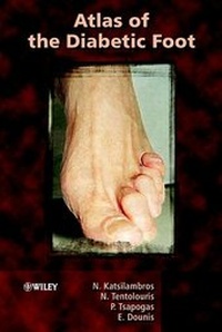 Abbildung von: Atlas of the Diabetic Foot - Wiley