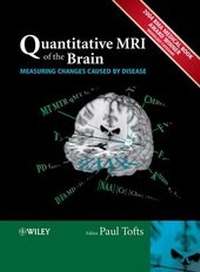 Abbildung von: Quantitative MRI of the Brain - Wiley