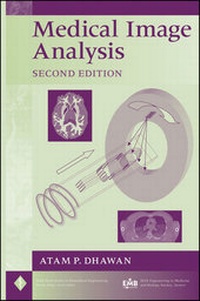 Abbildung von: Medical Image Analysis - Wiley-IEEE Press