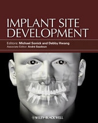 Abbildung von: Implant Site Development - Wiley-Blackwell