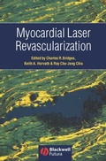 Bild: Myocardial Laser Revascularization - Wiley