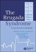 Cover: The Brugada Syndrome: From Bench to Bedside - Wiley