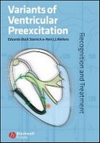Enlarge image Cover: Variants of Ventricular Preexcitation - Recognition and Treatment - Wiley