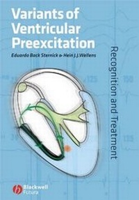 Enlarge image Cover: Variants of Ventricular Preexcitation - Wiley-Blackwell