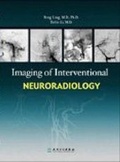 Cover: Imaging of Interventional Neuroradiology - People's Medical Publishing House