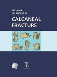 Abbildung von: Calcaneal Fracture - Sharpless Books, Inc.