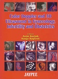 Cover: Colour Doppler and 3D Ultrasound in Gynaecology, Infertility and Obstetrics - Jaypee Brothers Medical Publishers
