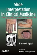 Cover: Slide Interpretation in Clinical Medicine - Jaypee Brothers Medical Publishers