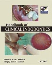 Enlarge image Cover: A Hand Book of Clinical Endodontics - Jaypee Brothers Medical Publishers