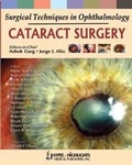 Cover: Surgical Techniques in Ophthalmology: Cataract Surgery - Jaypee Brothers Medical Publishers