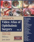 Cover: Jaypee's Video Atlas of Ophthalmic Surgery - Jaypee Brothers Medical Publishers
