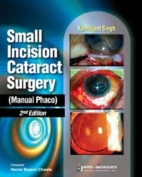 Enlarge image Cover: Small Incision Cataract Surgery (Manual Phaco) - Jaypee Brothers Medical Publishers