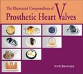 Bild: The Illustrated Compendium of Prosthetic Heart Valves - Academic Foundation