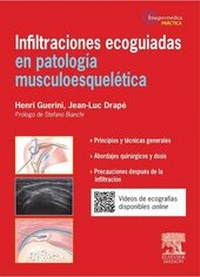Abbildung von: Infiltraciones ecoguiadas en patología musculoesquelética - Elsevier