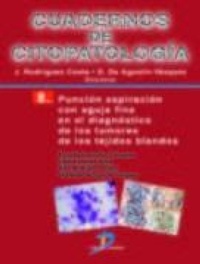 Abbildung von: Punción aspiración con aguja fina en el diagnósitco de los tumores de los tejidos blandos - Ediciones Díaz de Santos, S.A.
