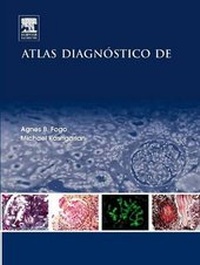Abbildung von: Atlas Diagnostico de Patologia Renal - Elsevier