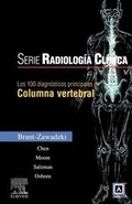 Cover: Los 100 Diagnosticos Principales En Columna Vertebral - Elsevier