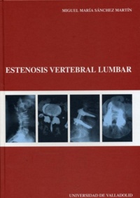 Abbildung von: Estenosis vertebral lumbar - Ediciones Universidad de Valladolid