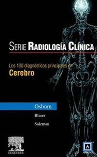 Abbildung von: Serie Radiologia Clinica: Los 100 Diagnosticos Principales En Cerebro - Elsevier