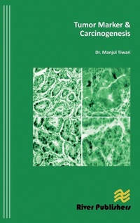 Abbildung von: Tumor Marker and Carcinogenesis - River Publishers