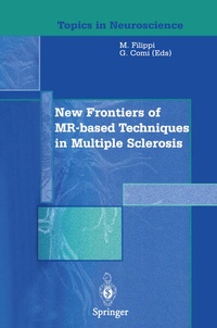 Abbildung von: New Frontiers of MR-based Techniques in Multiple Sclerosis - Springer