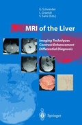 Cover: MRI of the Liver - Springer