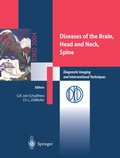 Cover: Diseases of the Brain, Head and Neck, Spine - Springer