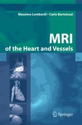 Cover: MRI of the Heart and Vessels - Springer