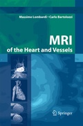 Cover: MRI of the Heart and Vessels - Springer