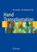 Cover: Hand transplantation - Springer
