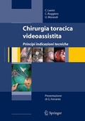Bild: Chirurgia toracica videoassistita - Springer