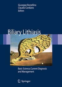 Abbildung von: Biliary Lithiasis - Springer