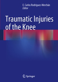 Abbildung von: Traumatic Injuries of the Knee - Springer