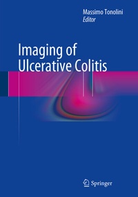 Abbildung von: Imaging of Ulcerative Colitis - Springer