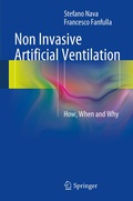 Cover: Non Invasive Artificial Ventilation - Springer