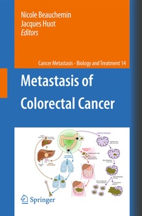 Abbildung von: Metastasis of Colorectal Cancer - Springer