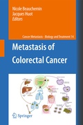 Cover: Metastasis of Colorectal Cancer - Springer