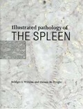 Cover: Illustrated Pathology of the Spleen - Cambridge University Press
