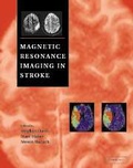 Cover: Magnetic Resonance Imaging in Stroke - Cambridge University Press