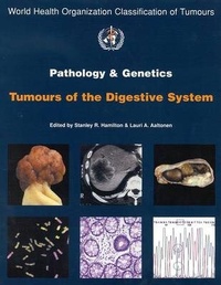Enlarge image Cover: Pathology and Genetics of Tumours of the Digestive System - International Agency for Research on Cancer