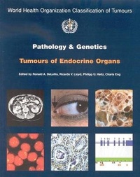 Abbildung von: Pathology and genetics of tumours of the endocrine organs - International Agency for Research on Cancer