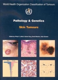 Abbildung von: Pathology and Genetics of Tumours of the Skin - IARC