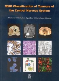 Abbildung von: WHO Classification of Tumours of the Central Nervous System: WHO Classification of Tumours Volume 1 - World Health Organization