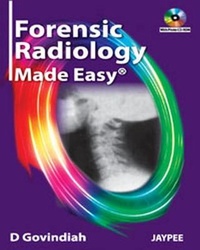 Abbildung von: Forensic Radiology Made Easy - Jaypee Brothers Medical Publishers