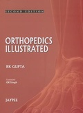 Cover: Orthopedics Illustrated - Jaypee Brothers Medical Publishers