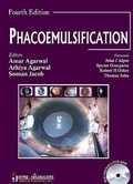 Cover: Phacoemulsification, Fourth Edition - Jaypee Brothers Medical Publishers