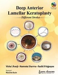 Cover: Deep Anterior Lamellar Keratoplasty Different Strokes - Jaypee Brothers Medical Publishers